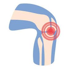 Knee Osteoarthritis Treatment in Delhi